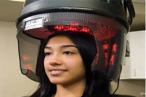 Anti Hair Loss Treatment Anti Hair Loss Treatment